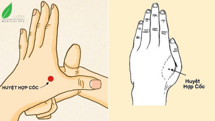 Bấm huyệt Hợp Cốc giúp giảm đau đầu hiệu quả