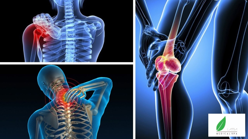 Các bệnh lý về cơ xương khớp là nguyên nhân làm đau lưng tê tay mỏi gối