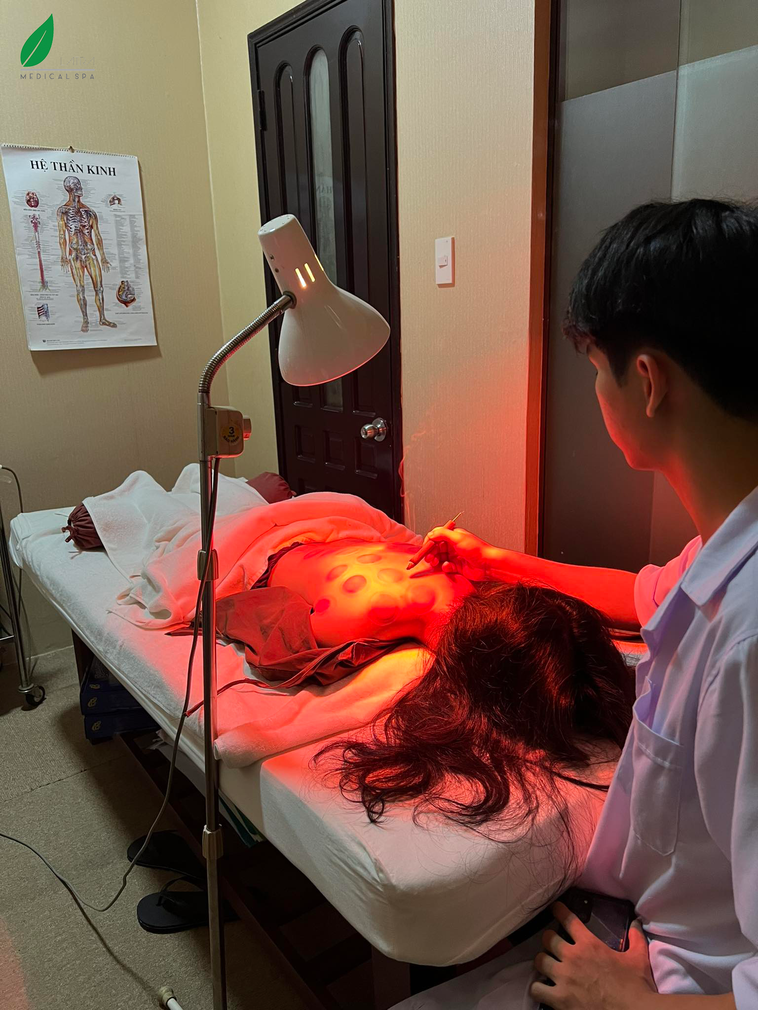 Cứu Huyệt tại Lá Trà Medical Spa